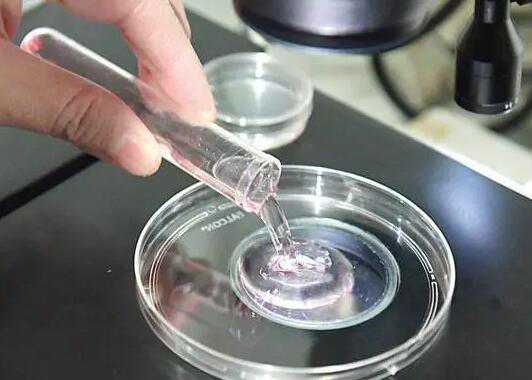 无锡试管代孕步骤有哪些_61862_qXyH2_8036i_两步移植法移植两个胚胎成双胞胎的多