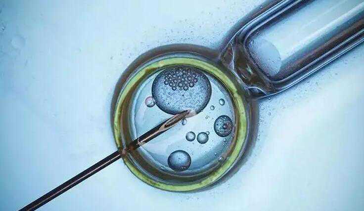 无锡提供捐卵中介 无锡生育险进度查询网 ‘37天孕囊大小两个是男还是女?’