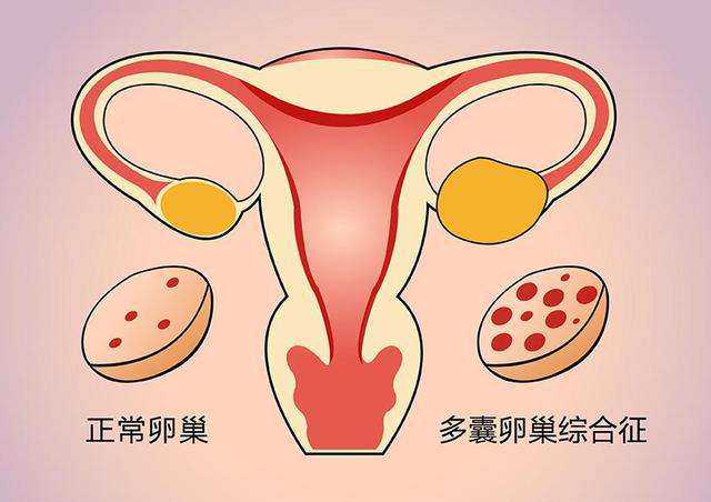 昆明助孕试管助孕大概多少钱_广州南方医院试管少钱？取卵移植要注意的问题